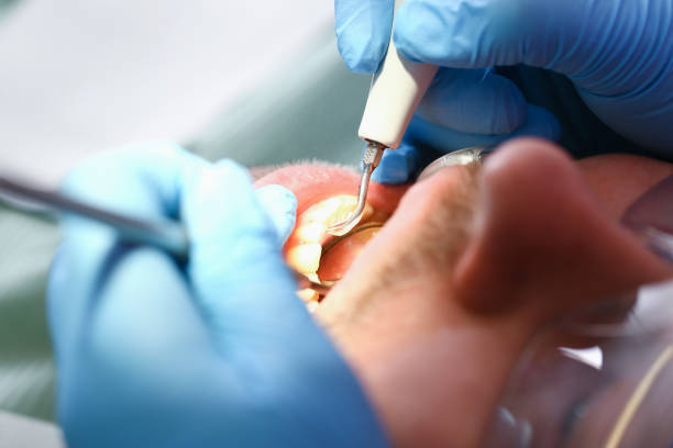 Best Broken or Chipped Tooth Repair in East Foothills, CA