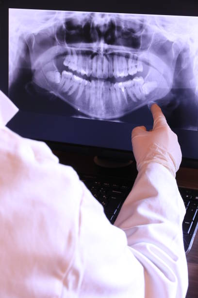Best Emergency Wisdom Tooth Extraction in East Foothills, CA